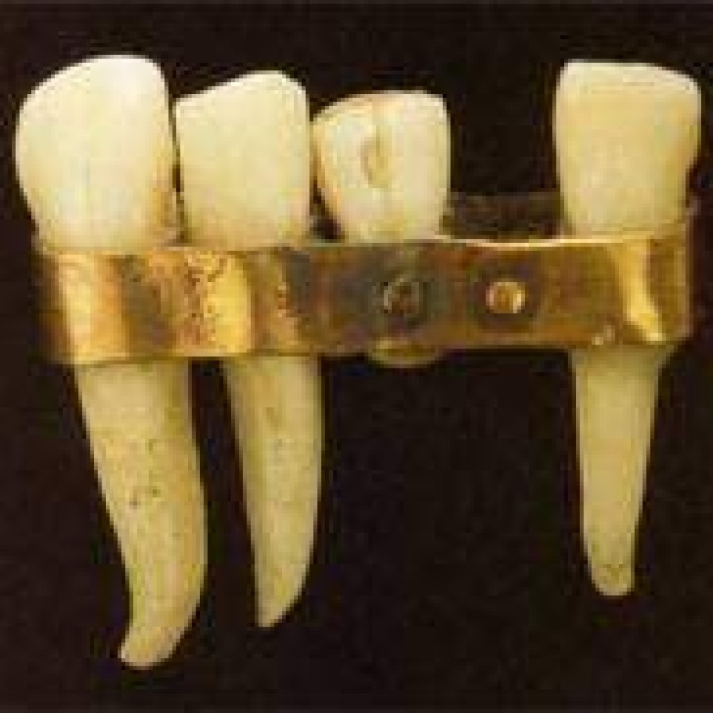 Зубные протезы этрусков в древнем Риме