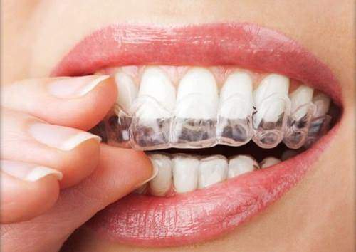 Las férulas de retención de ortodoncia, ¿me sirven como placa de descarga?